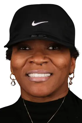 Confident smile transformation with dental implants and custom crowns.